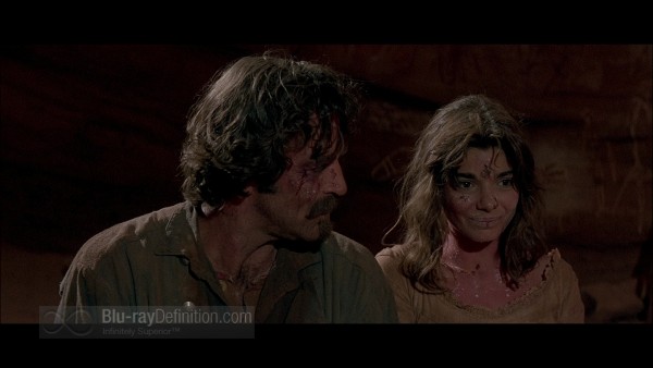 Quigley_Down_Under15